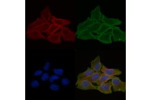 ABIN6258861 and ABIN6274219 staining Hela cells(30 min of UV treatment) by IF/ICC. (ITPKB Antikörper  (Internal Region))