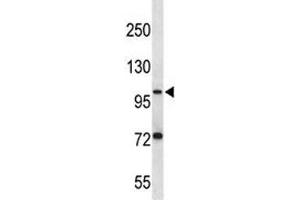 PSMA antibody western blot analysis in ZR-75-1 lysate. (PSMA Antikörper  (AA 161-190))