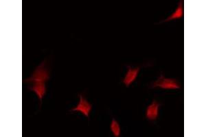 ABIN6267587 staining Hela by IF/ICC. (RUNX1 Antikörper  (pSer276))