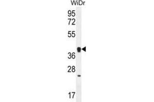 Western Blotting (WB) image for anti-Olfactory Receptor, Family 2, Subfamily T, Member 8 (OR2T8) antibody (ABIN2996544) (OR2T8 Antikörper)