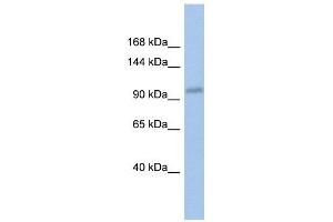 DDX24 antibody used at 1 ug/ml to detect target protein. (DDX24 Antikörper)