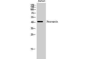 Western Blotting (WB) image for anti-Opsin 5 (OPN5) (C-Term) antibody (ABIN3185858) (OPN5 Antikörper  (C-Term))
