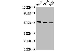 Western Blot Positive WB detected in: Hela whole cell lysate, A549 whole cell lysate, PC-3 whole cell lysate All lanes: ALS2CR12 antibody at 12 μg/mL Secondary Goat polyclonal to rabbit IgG at 1/50000 dilution Predicted band size: 53, 50 kDa Observed band size: 53 kDa (ALS2CR12 Antikörper  (AA 26-76))