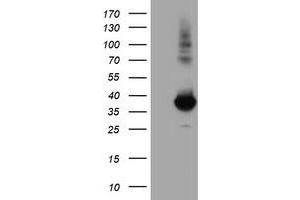 Western Blotting (WB) image for anti-Monoglyceride Lipase (MGLL) antibody (ABIN1499443) (MGLL Antikörper)
