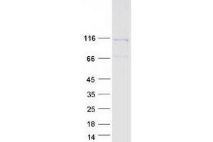 Western Blotting (WB) image for Dishevelled Associated Activator of Morphogenesis 1 (DAAM1) protein (Myc-DYKDDDDK Tag) (ABIN2712410)
