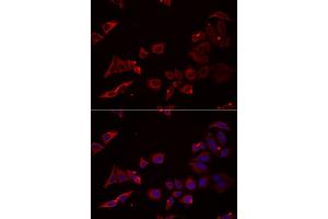 Immunofluorescence analysis of U2OS cells using NRBF2 antibody. (NRBF2 Antikörper)