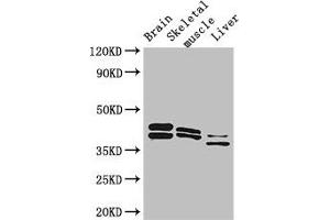 Western Blot Positive WB detected in: Mouse brain tissue, Mouse skeletal muscle tissue, Mouse liver tissue All lanes: ALDOC antibody at 3 μg/mL Secondary Goat polyclonal to rabbit IgG at 1/50000 dilution Predicted band size: 40 kDa Observed band size: 40, 36, 42 kDa (ALDOC Antikörper  (AA 190-354))
