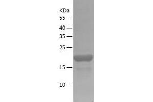 Western Blotting (WB) image for ADP-Ribosylation Factor-Like 5A (ARL5A) (AA 1-179) protein (His tag) (ABIN7121748)