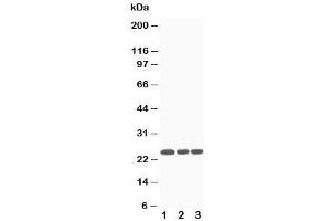 Western blot testing of SOCS3 antibody and Lane 1:  Jurkat