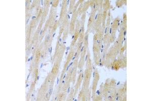 Immunohistochemistry (Paraffin-embedded Sections) (IHC (p)) image for anti-Ubiquitin-Conjugating Enzyme E2L 3 (UBE2L3) (AA 73-212) antibody (ABIN1683196)