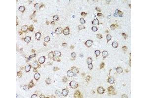 Immunohistochemistry of paraffin-embedded Mouse brain using NOTCH2 Polyclonal Antibody at dilution of 1:100 (40x lens).