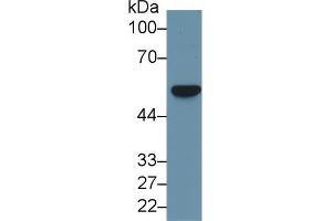 Western blot analysis of Human HeLa cell lysate, using Rat FSCN Antibody (1 µg/ml) and HRP-conjugated Goat Anti-Rabbit antibody ( (Fascin Antikörper  (AA 8-260))