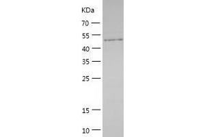 Western Blotting (WB) image for Laminin, alpha 5 (LAMA5) (AA 3027-3482) protein (His tag) (ABIN7123714) (Laminin alpha 5 Protein (AA 3027-3482) (His tag))