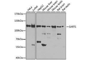 Western blot analysis of extracts of various cell lines, using SART1 antibody.