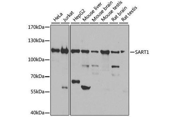 SART1 antibody  (AA 1-255)