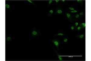 Immunofluorescence (IF) image for anti-Activity-Dependent Neuroprotector Homeobox (ADNP) (AA 1018-1102) antibody (ABIN525133)