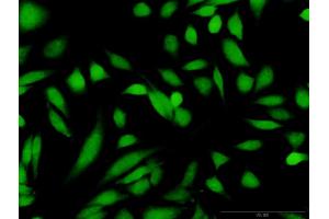 Immunofluorescence (IF) image for anti-Glucokinase (Hexokinase 4) (GCK) (AA 1-465) antibody (ABIN515989)