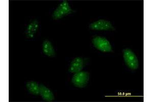 Immunofluorescence of purified MaxPab antibody to UPF3A on HeLa cell. (UPF3A Antikörper  (AA 1-443))