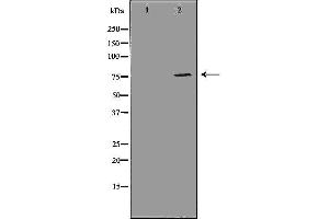 Western blot analysis of MDA MB 361 cell lysate, using ATF6 Antibody. (ATF6 Antikörper  (Internal Region))