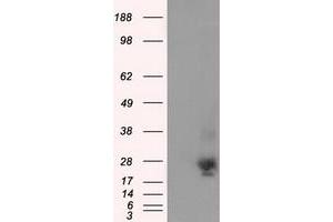 Image no. 3 for anti-NME/NM23 Nucleoside Diphosphate Kinase 4 (NME4) antibody (ABIN1499772) (NME4 Antikörper)