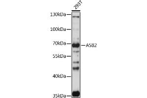 Western blot analysis of extracts of 293T cells, using  antibody (ABIN7265612) at 1:1000 dilution. (ASB2 Antikörper  (AA 448-587))