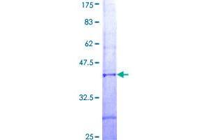 SPPL2C Protein (AA 29-122) (GST tag)