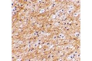 Immunohistochemistry (IHC) image for anti-Apoptosis-Inducing Factor, Mitochondrion-Associated, 3 (AIFM3) (N-Term) antibody (ABIN1031221)