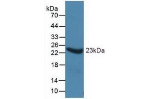 Detection of Recombinant a1AGP, Human using Monoclonal Antibody to Alpha-1-Acid Glycoprotein (a1AGP) (ORM1 Antikörper  (AA 19-201))