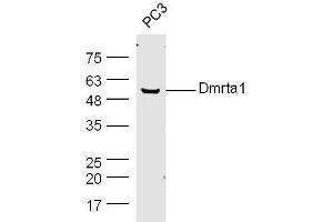 PC3 cell lysates probed with Rabbit Anti-DMO/Dmrt1a Polyclonal Antibody, Unconjugated  at 1:300 overnight at 4˚C. (DMO/Dmrt1a (AA 51-100) Antikörper)