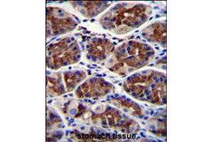 EPHX3 Antibody immunohistochemistry analysis in formalin fixed and paraffin embedded human stomach tissue followed by peroxidase conjugation of the secondary antibody and DAB staining. (ABHD9 Antikörper  (C-Term))