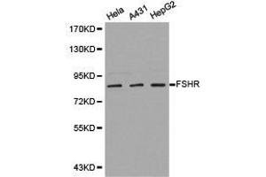 Western Blotting (WB) image for anti-Follicle Stimulating Hormone Receptor (FSHR) antibody (ABIN1872742) (FSHR Antikörper)