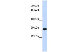 WB Suggested Anti-CTRB1 Antibody Titration:  0. (CTRB1 Antikörper  (Middle Region))