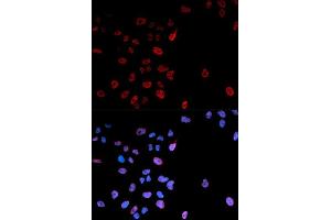 Immunofluorescence analysis of U2OS cell using Phospho-MYC-S62 antibody. (c-MYC Antikörper  (pSer62))