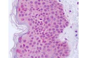 Anti-EGFR antibody IHC staining of human skin. (EGFR Antikörper)