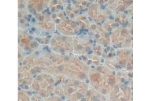 Used in DAB staining on fromalin fixed paraffin- embedded Kidney tissue (SNX18 Antikörper  (AA 411-614))
