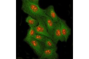 IF analysis of RRP8 and Tubulin beta using anti-RRP8 antibody (ABIN7600459) and anti-Tubulin beta antibody (ABIN7602744). (RRP8 Antikörper  (AA 199-456))