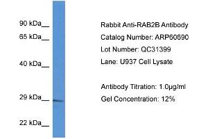 Western Blotting (WB) image for anti-RAB2B, Member RAS Oncogene Family (RAB2B) (C-Term) antibody (ABIN2788538) (RAB2B Antikörper  (C-Term))