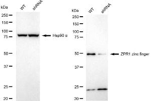 Western blotting analysis using ZPR1 zinc finger antibody (ABIN7800895). (Rekombinanter ZNF259 Antikörper)
