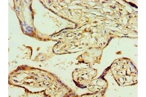 Immunohistochemistry of paraffin-embedded human placenta tissue using ABIN7142020 at dilution of 1:100 (AGPAT1 Antikörper  (AA 204-283))