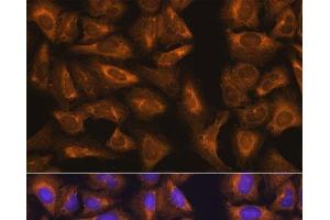 Immunofluorescence analysis of U-2 OS cells using RPL17 Polyclonal Antibody at dilution of 1:100. (RPL17 Antikörper)