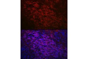 Immunofluorescence analysis of mouse spleen using CD79a Rabbit pAb (ABIN1679100, ABIN3015116, ABIN3015118 and ABIN6213808) at dilution of 1:50 (40x lens). (CD79a Antikörper  (AA 33-145))