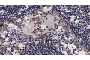 ABIN6266817 at 1/100 staining human Lymph node tissue sections by IHC-P. (NT5C3 Antikörper  (N-Term))