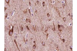 ABIN6266954 at 1/100 staining human brain tissue sections by IHC-P. (ZNF287 Antikörper)