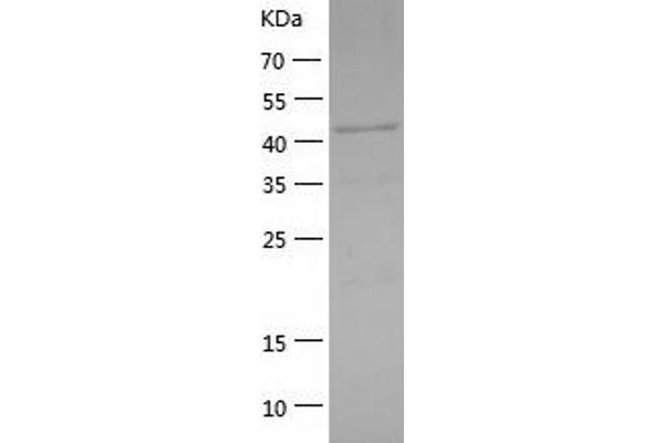 GATA1 Protein (AA 2-413) (His tag)