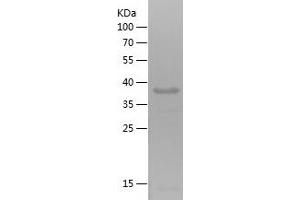 CD56 Protein (AA 344-619) (His tag)