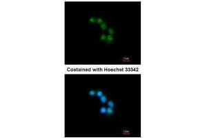ICC/IF Image Immunofluorescence analysis of methanol-fixed HepG2, using STXBP2, antibody at 1:200 dilution.