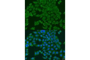 Immunofluorescence analysis of U2OS cells using PIWIL1 antibody (ABIN2564557) at dilution of 1:100. (PIWIL1 Antikörper)