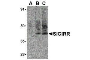 Western Blotting (WB) image for anti-Single Immunoglobulin and Toll-Interleukin 1 Receptor (TIR) Domain (SIGIRR) (C-Term) antibody (ABIN2476474) (SIGIRR Antikörper  (C-Term))