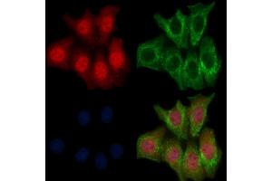 ABIN6265317 and ABIN6269240 staining Hela cells by IF/ICC.