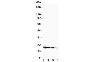 Western Blotting (WB) image for anti-Fibroblast Growth Factor 1 (Acidic) (FGF1) (AA 16-155) antibody (ABIN3030929)